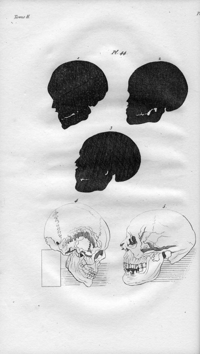 L'art de connaitre les hommes par la physionomie. Nouvelle édition corrigée et disposée dans un ordre plus méthodique, augmentée d'une exposition des recherches ou des opinions de La Chambre, de Porta, de Camper, de Gall, sur la physionomie ; d'une histoire anatomique et physiologique de la face ; précédée d'une notice historique sur l'auteur, par Moreau (de la Sarthe). Ornée de 600 gravures en taille-douce, dont 82 tirées en couleurs et exécutées sous l'inspection de Vincent, peintre. 