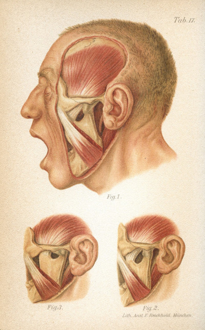 Atlas-manuel des fractures et luxations. Deuxième édition française refondue et augmentée par le Docteur Paul Delbet. Avec 68 planches chromolithographiées entièrement refaites et 137 figures dans le texte. 