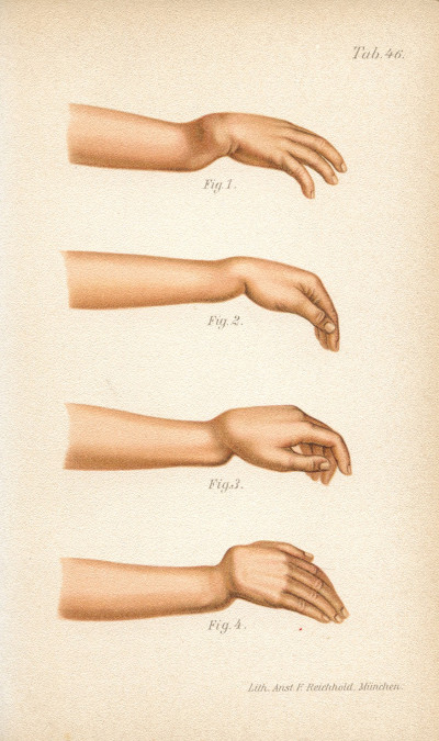 Atlas-manuel des fractures et luxations. Deuxième édition française refondue et augmentée par le Docteur Paul Delbet. Avec 68 planches chromolithographiées entièrement refaites et 137 figures dans le texte. 