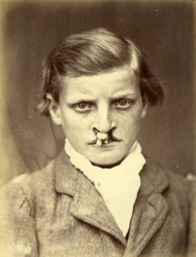 Revue photographique des Hôpitaux de Paris. Deuxième année. 