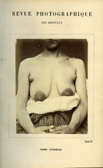 Revue photographique des Hôpitaux de Paris. Deuxième année. 