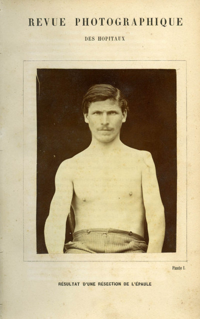 Revue photographique des Hôpitaux de Paris. Deuxième année. 