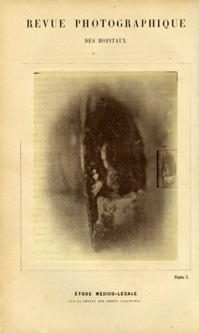 Revue photographique des Hôpitaux de Paris. Deuxième année. 