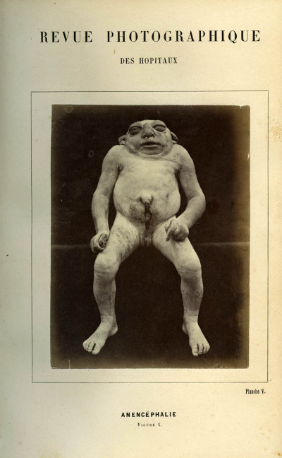 Revue photographique des Hôpitaux de Paris. Deuxième année. 