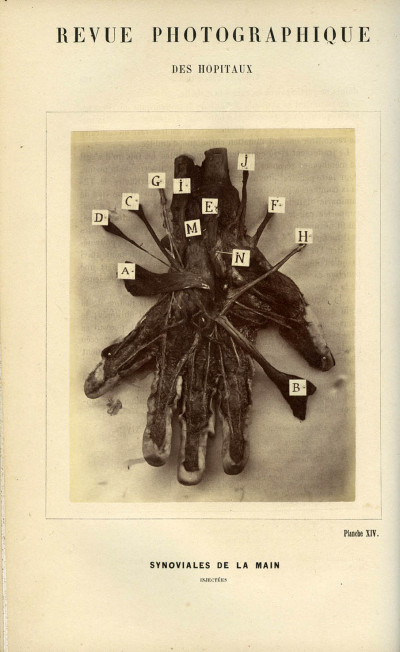 Revue photographique des Hôpitaux de Paris. Deuxième année. 