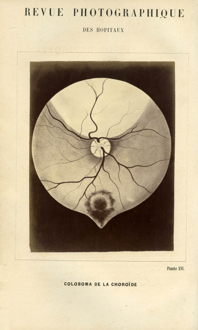 Revue photographique des Hôpitaux de Paris. Deuxième année. 