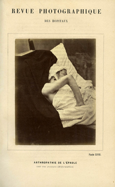 Revue photographique des Hôpitaux de Paris. Deuxième année. 