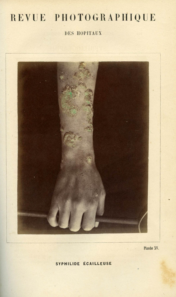 Revue photographique des Hôpitaux de Paris. Deuxième année. 